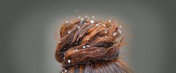 перхоть нар средства 4